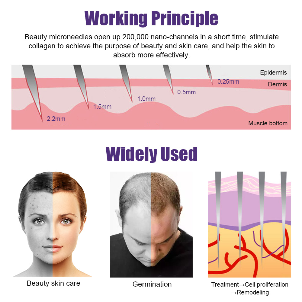 Natural Men Beard Growth Derma - Derma Roller 0.25 reseña y precio