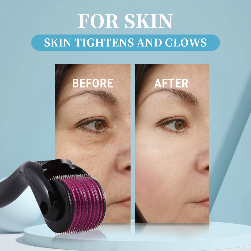 Professional 540 Roller Derma  - Derma Roller 0.25 reseña y precio