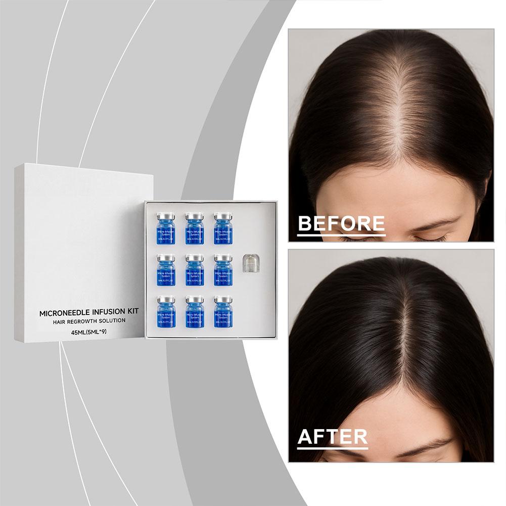0.25mm Hair Essential Serum Mi - Derma Roller 0.25 reseña y precio
