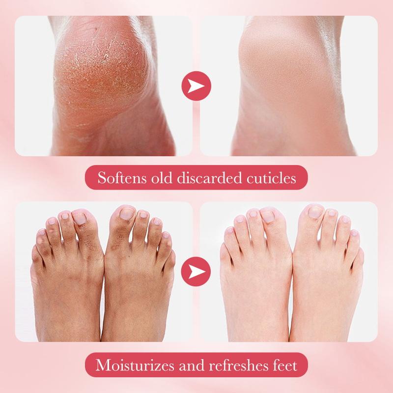 1 Pairs SADOER Fruits Foot Mas - Spa & Wellness Hotel Diament Ustroń Opinie reseña y precio